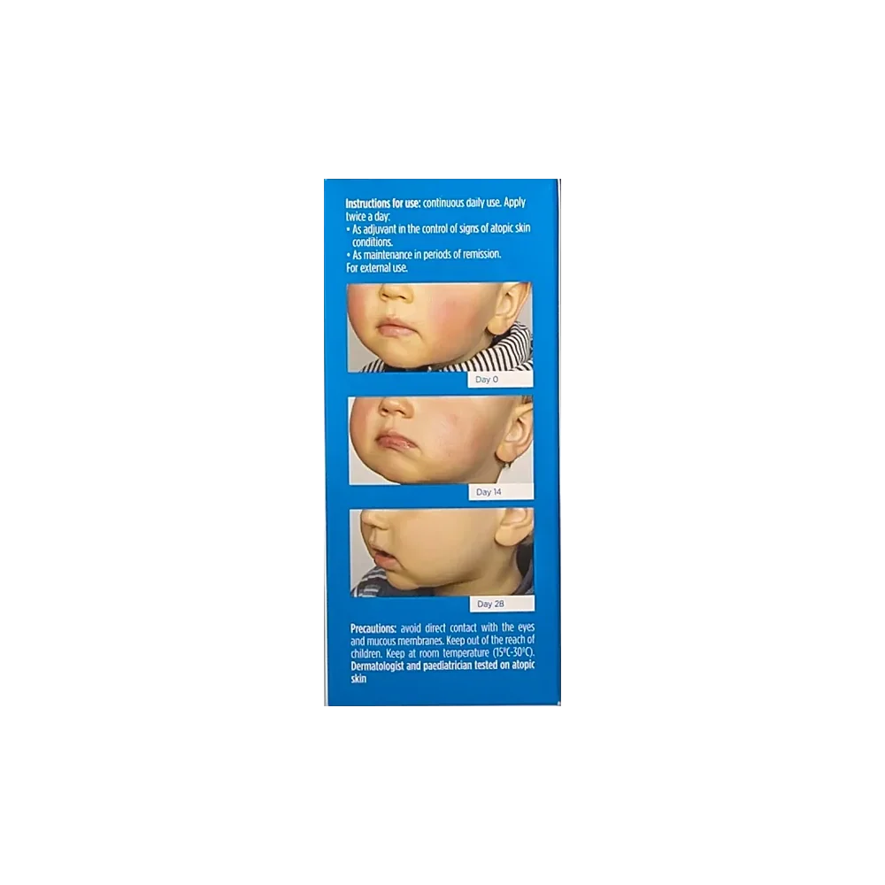 ISDIN NUTRATOPIC PRO-AMP FACIAL CREAM relieves itchiness and dryness